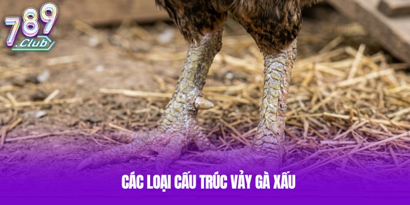 Các loại cấu trúc vảy gà xấu